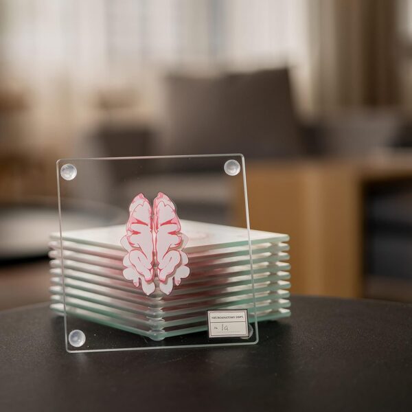 Anatomic Brain Specimen Coasters (Set of 10) - Neuroscience Gifts Best Red - Image 6