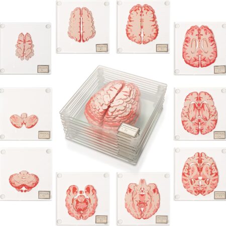 Anatomic Brain Specimen Coasters (Set of 10) - Neuroscience Gifts Best Red