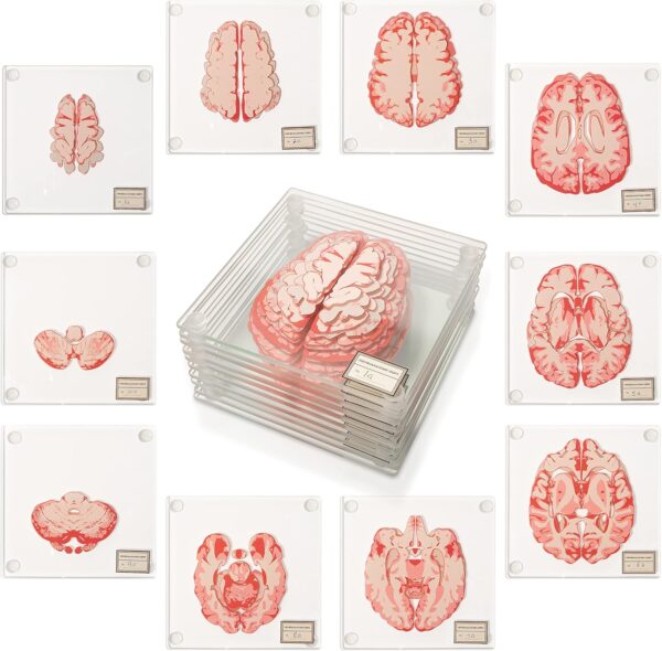 Anatomic Brain Specimen Coasters (Set of 10) - Neuroscience Gifts Best Red